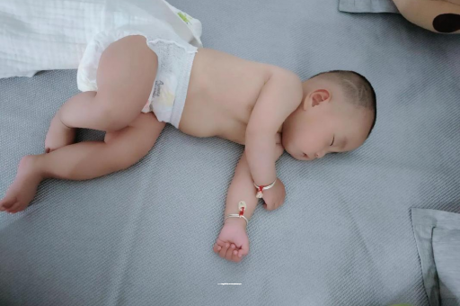 任丘宝宝头上长痱子